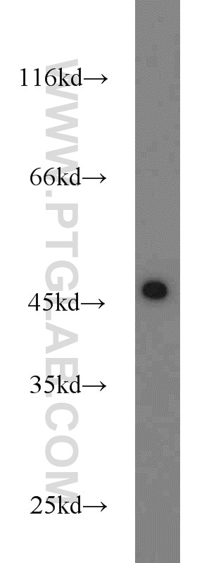 Western Blot (WB) analysis of SH-SY5Y cells using KLHL14-Specific Polyclonal antibody (14849-1-AP)