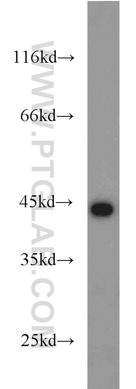 Western Blot (WB) analysis of mouse brain tissue using KLHL14-Specific Polyclonal antibody (14849-1-AP)