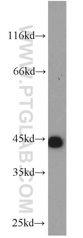 Western Blot (WB) analysis of HeLa cells using KLHL14-Specific Polyclonal antibody (14849-1-AP)