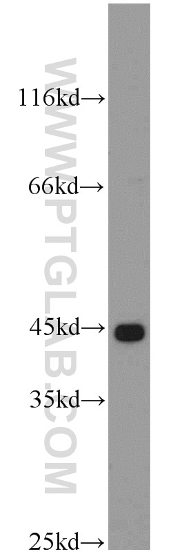 Western Blot (WB) analysis of HepG2 cells using KLHL14-Specific Polyclonal antibody (14849-1-AP)