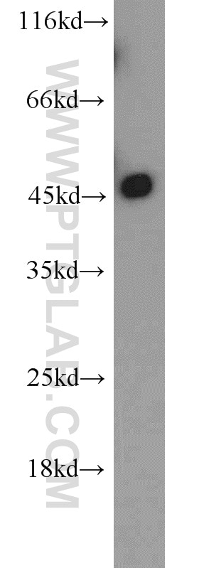 Western Blot (WB) analysis of rat brain tissue using KLHL14-Specific Polyclonal antibody (14849-1-AP)