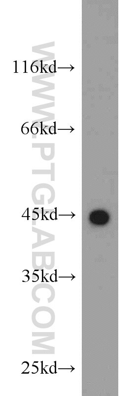 Western Blot (WB) analysis of HeLa cells using KLHL14-Specific Polyclonal antibody (14849-1-AP)