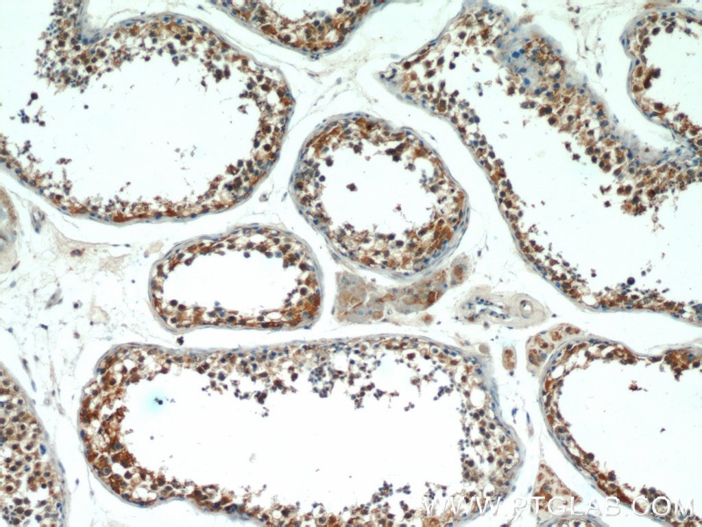 Immunohistochemistry (IHC) staining of human testis tissue using KLHL15 Polyclonal antibody (25066-1-AP)