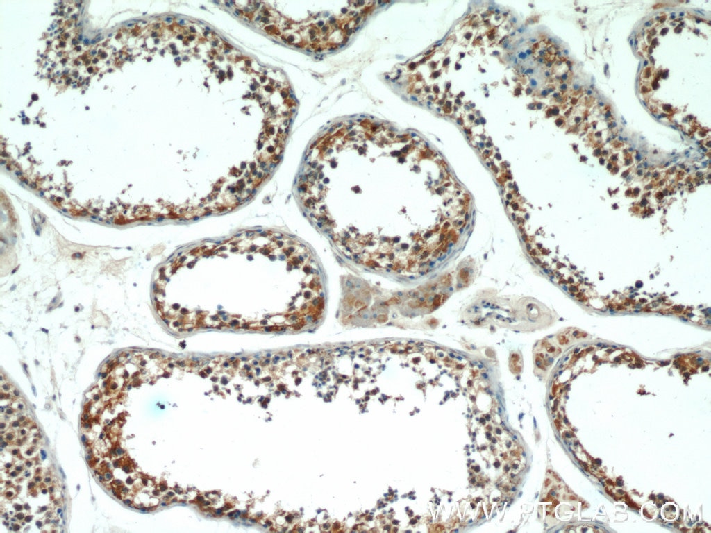 IHC staining of human testis using 25066-1-AP