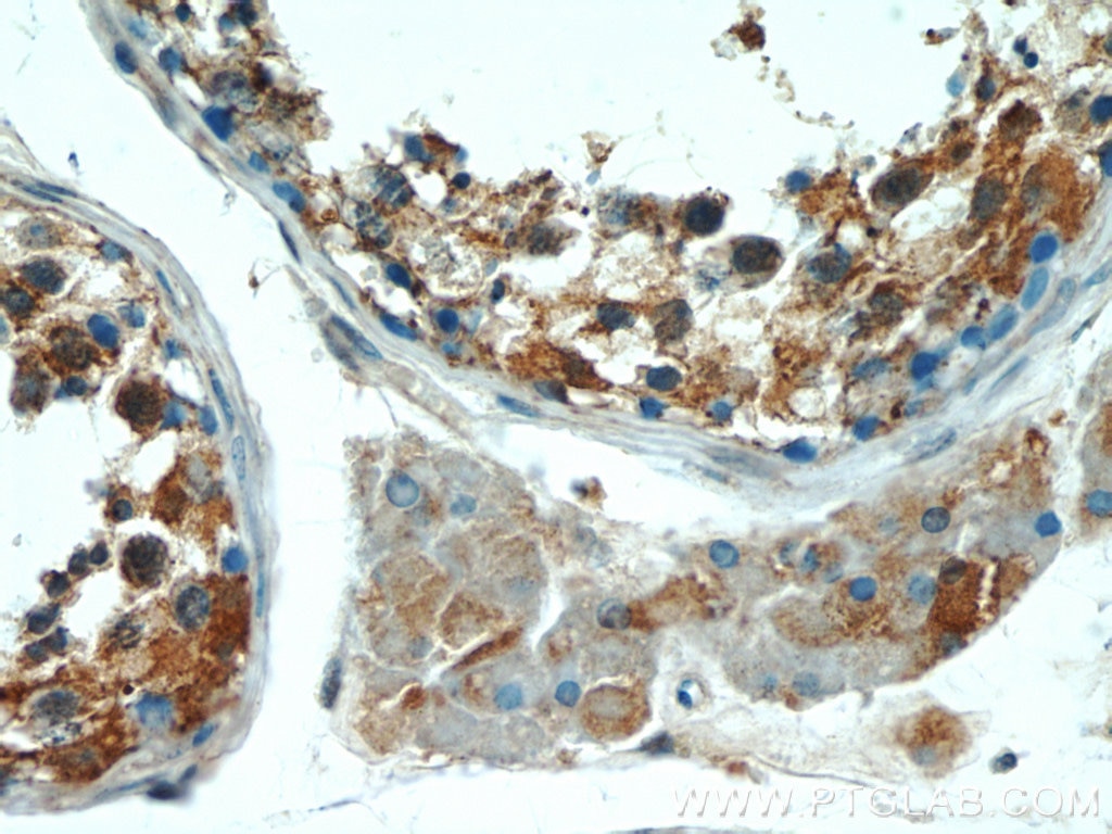 Immunohistochemistry (IHC) staining of human testis tissue using KLHL15 Polyclonal antibody (25066-1-AP)