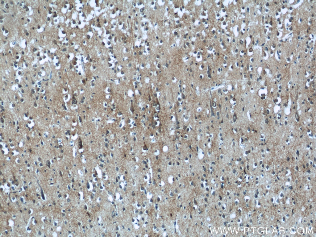 Immunohistochemistry (IHC) staining of human brain tissue using KLHL15 Polyclonal antibody (25066-1-AP)