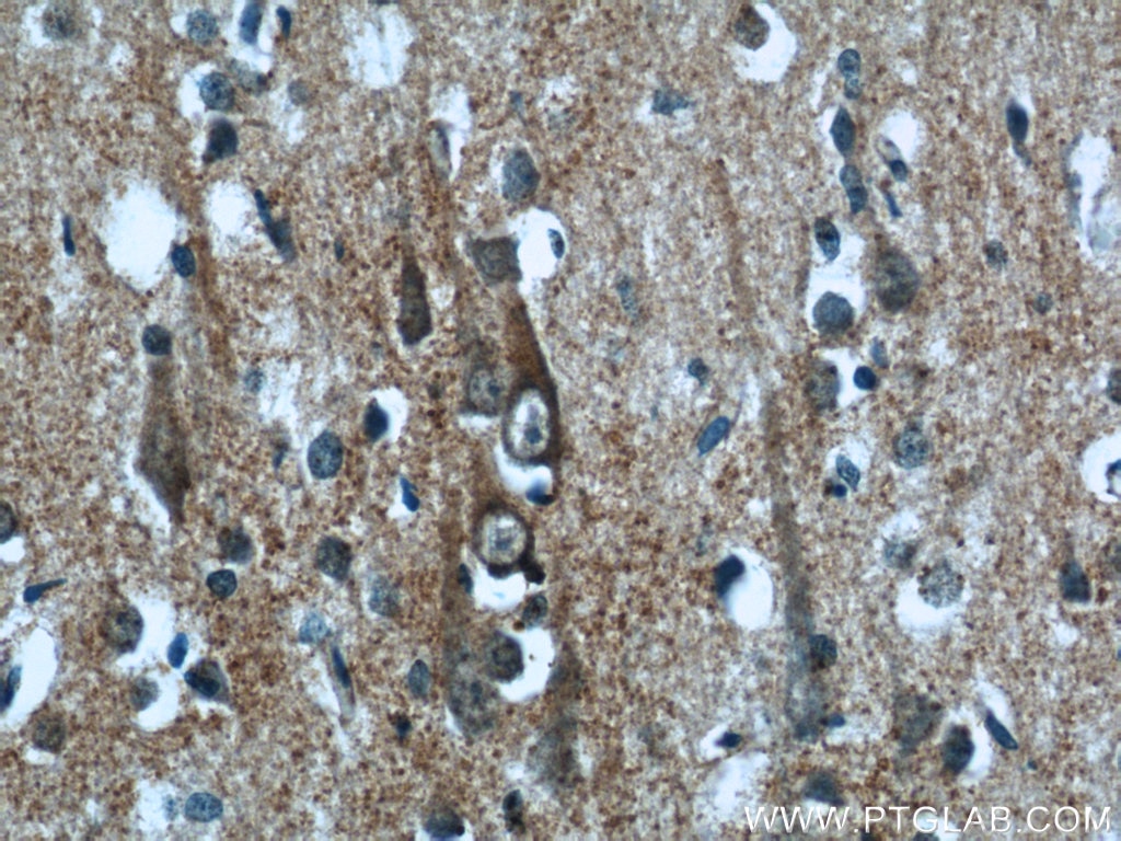 Immunohistochemistry (IHC) staining of human brain tissue using KLHL15 Polyclonal antibody (25066-1-AP)