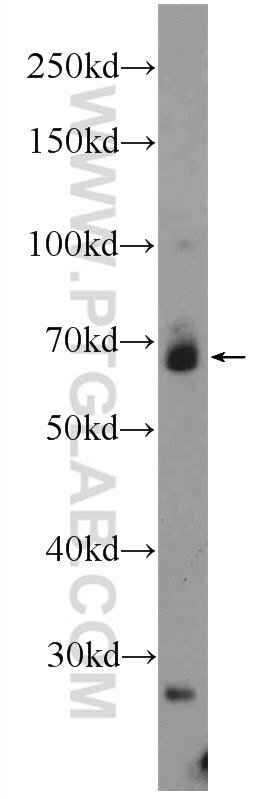 Western Blot (WB) analysis of HEK-293 cells using KLHL15 Polyclonal antibody (25066-1-AP)