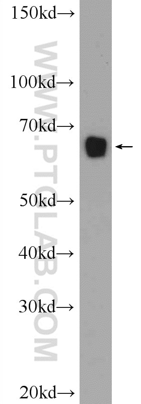 Western Blot (WB) analysis of HeLa cells using KLHL15 Polyclonal antibody (25066-1-AP)