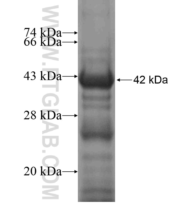KLHL15 fusion protein Ag16878 SDS-PAGE