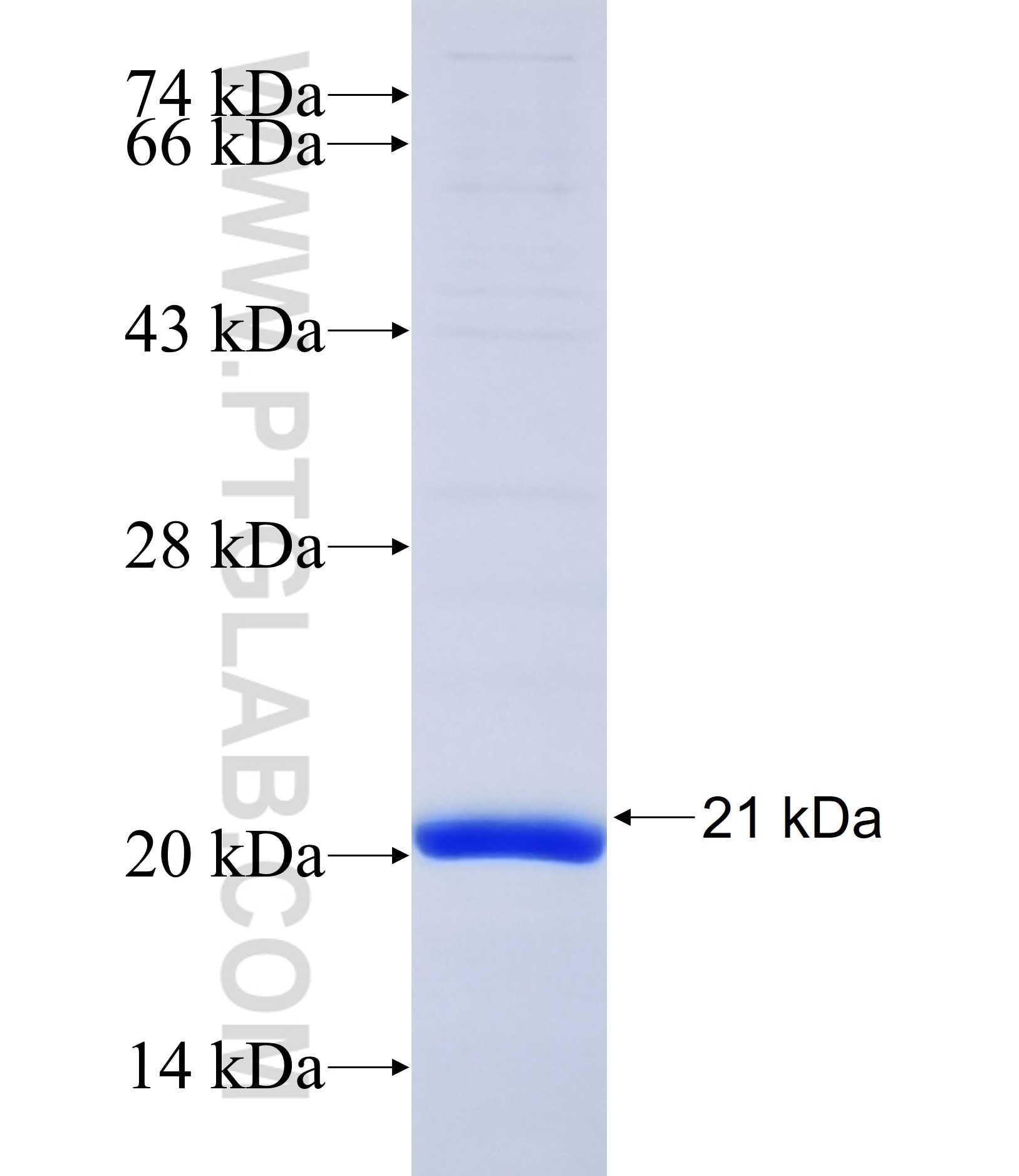 KLHL17 fusion protein Ag37183 SDS-PAGE KLHL17 fusion protein Ag37183 SDS-PAGE