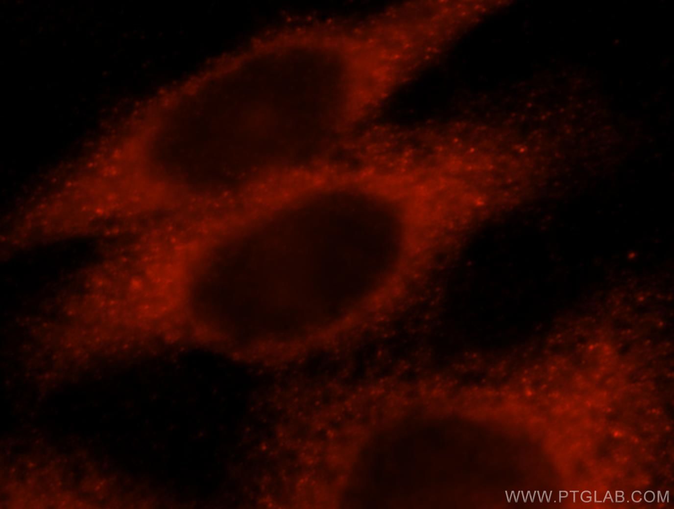 Immunofluorescence (IF) / fluorescent staining of HeLa cells using KLHL18 Polyclonal antibody (17229-1-AP)
