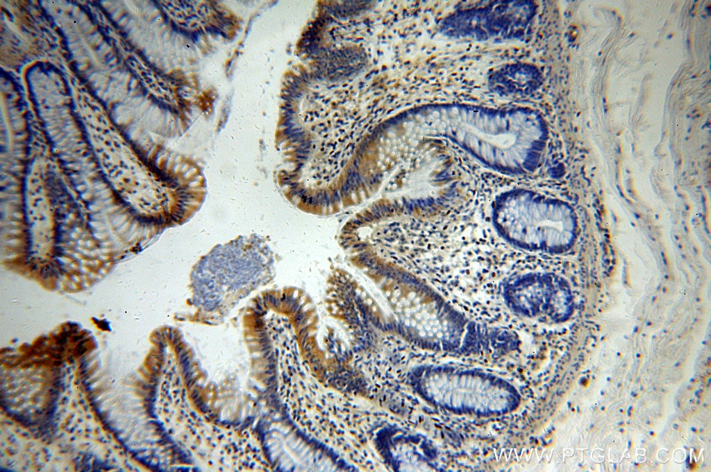 Immunohistochemistry (IHC) staining of human colon tissue using KLHL18 Polyclonal antibody (17229-1-AP)