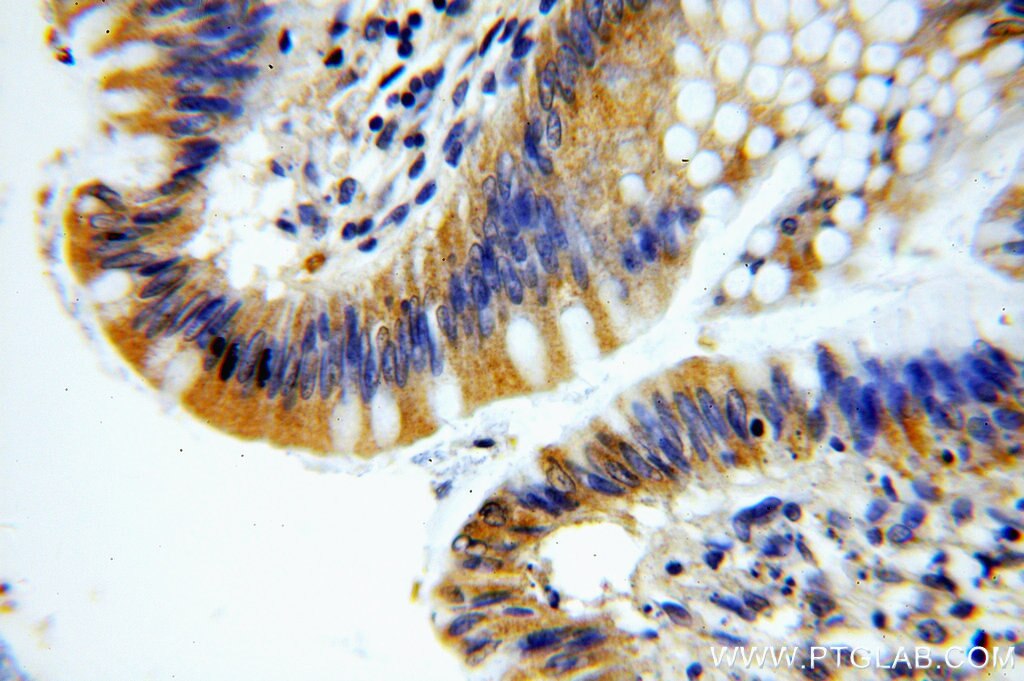 Immunohistochemistry (IHC) staining of human colon tissue using KLHL18 Polyclonal antibody (17229-1-AP)