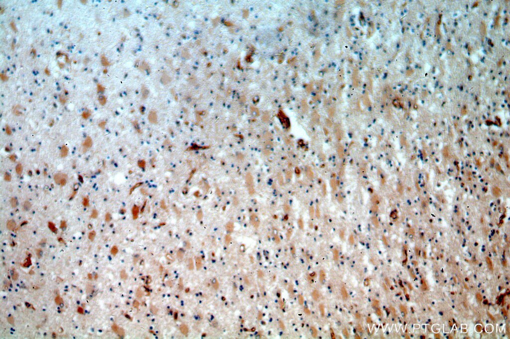 Immunohistochemistry (IHC) staining of human brain tissue using KLHL18 Polyclonal antibody (17229-1-AP)