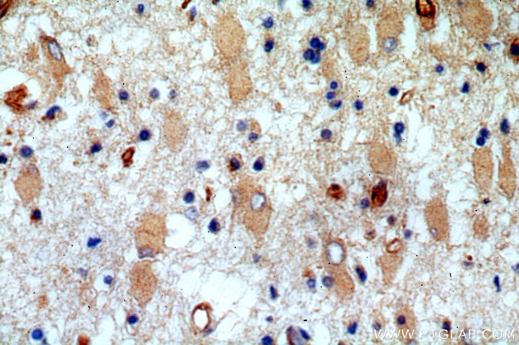 IHC staining of human brain using 17229-1-AP