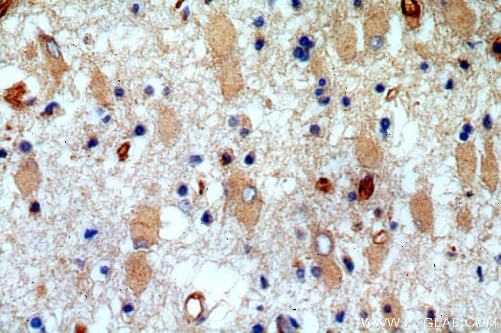 Immunohistochemistry (IHC) staining of human brain tissue using KLHL18 Polyclonal antibody (17229-1-AP)