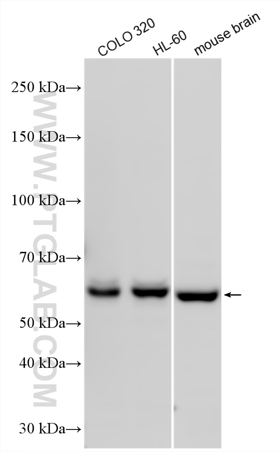 Western Blot (WB) analysis of various lysates using KLHL18 Polyclonal antibody (17229-1-AP)