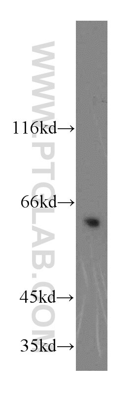 Western Blot (WB) analysis of HeLa cells using KLHL18 Polyclonal antibody (17229-1-AP)