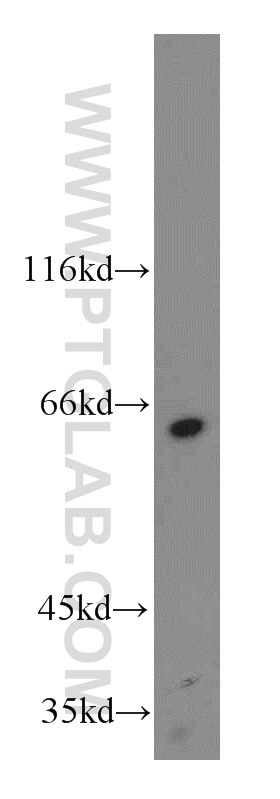 Western Blot (WB) analysis of COLO 320 cells using KLHL18 Polyclonal antibody (17229-1-AP)