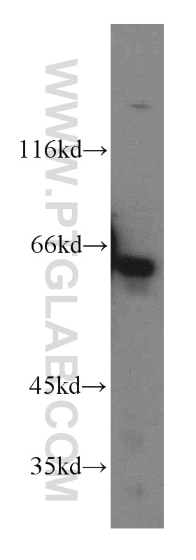 Western Blot (WB) analysis of HepG2 cells using KLHL18 Polyclonal antibody (17229-1-AP)