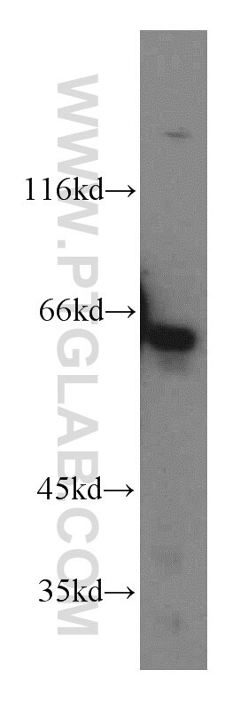 Western Blot (WB) analysis of HepG2 cells using KLHL18 Polyclonal antibody (17229-1-AP)