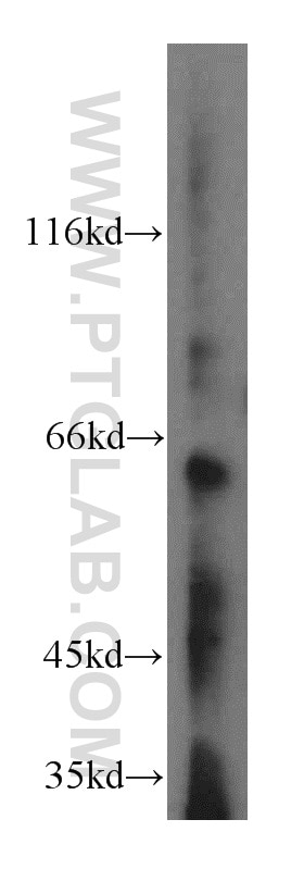 Western Blot (WB) analysis of mouse brain tissue using KLHL18 Polyclonal antibody (17229-1-AP)