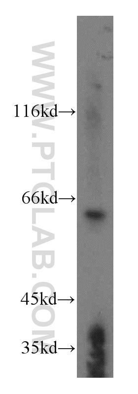Western Blot (WB) analysis of HEK-293 cells using KLHL18 Polyclonal antibody (17229-1-AP)