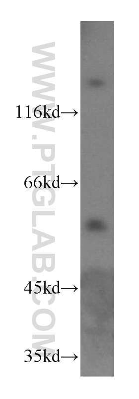 Western Blot (WB) analysis of HL-60 cells using KLHL18 Polyclonal antibody (17229-1-AP)