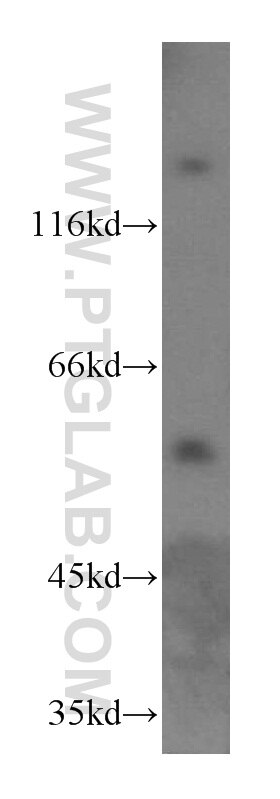 WB analysis of HL-60 using 17229-1-AP