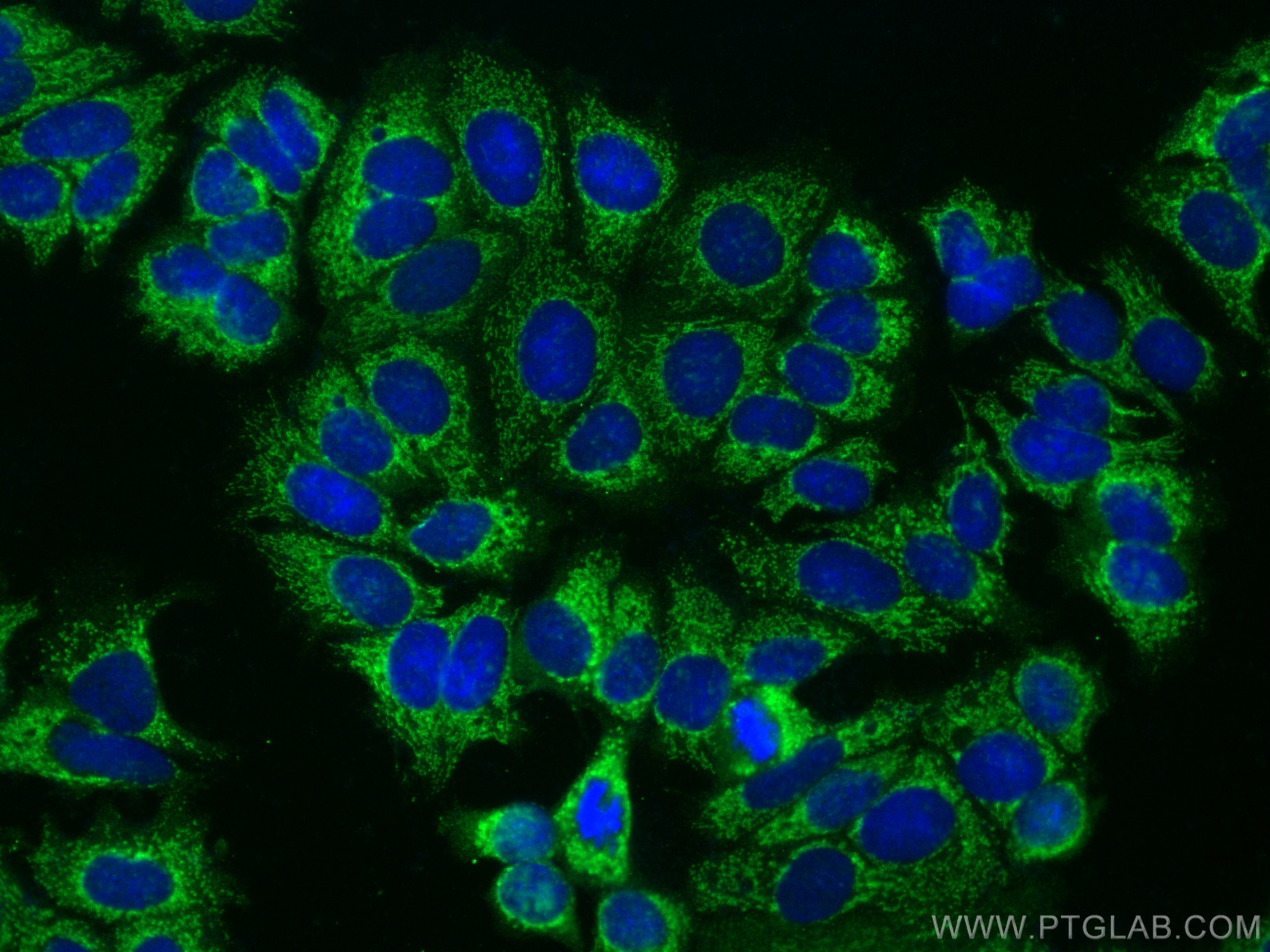 Immunofluorescence (IF) / fluorescent staining of MCF-7 cells using KLHL2 Polyclonal antibody (14449-1-AP)