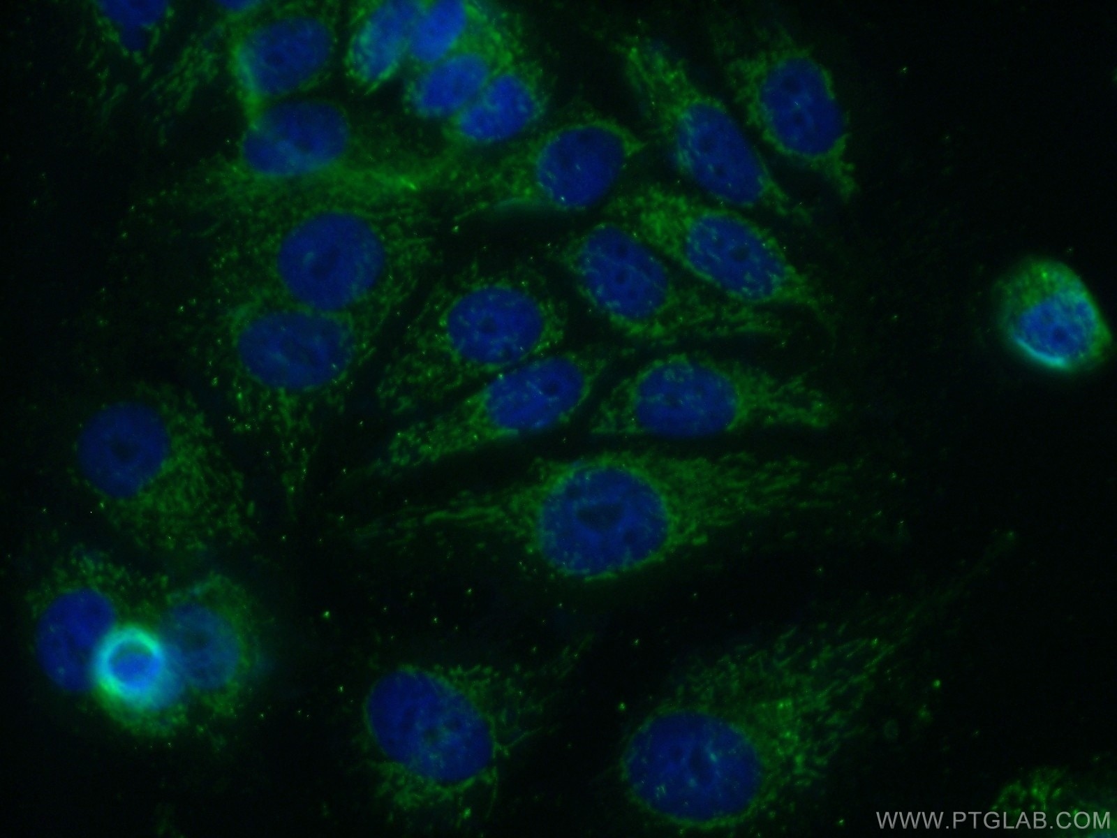 Immunofluorescence (IF) / fluorescent staining of MCF-7 cells using KLHL2 Polyclonal antibody (14449-1-AP)
