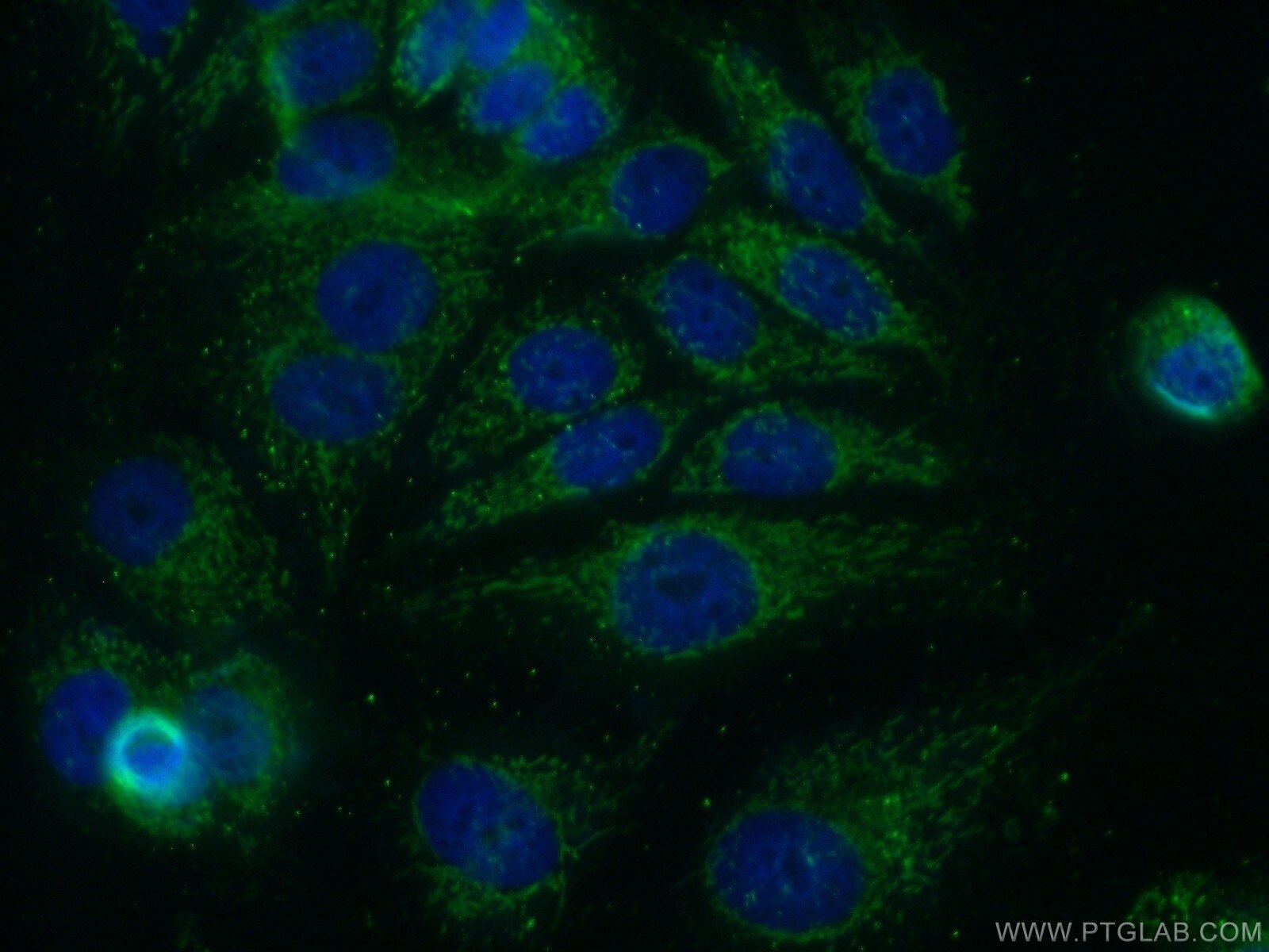 IF Staining of MCF-7 using 14449-1-AP