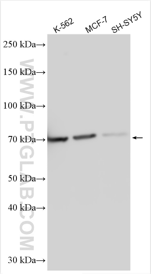 Western Blot (WB) analysis of various lysates using KLHL2 Polyclonal antibody (14449-1-AP)