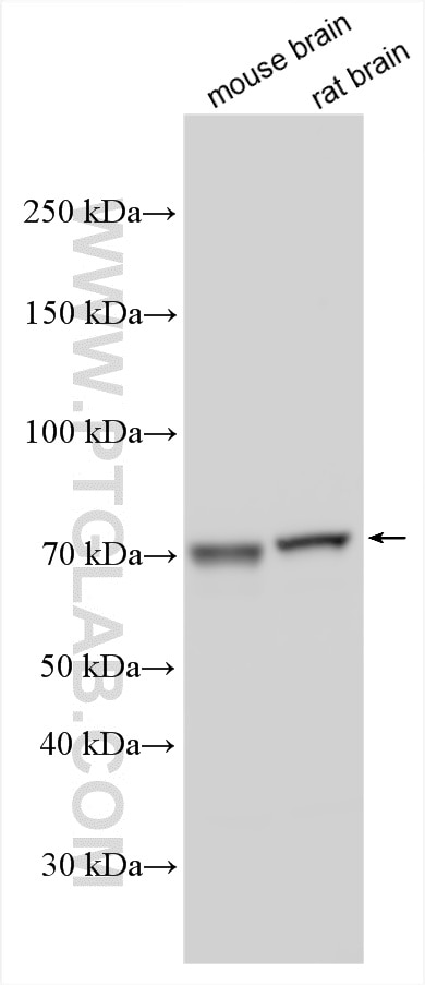 Western Blot (WB) analysis of various lysates using KLHL2 Polyclonal antibody (14449-1-AP)
