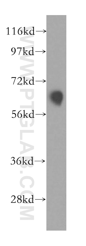 Western Blot (WB) analysis of MCF-7 cells using KLHL2 Polyclonal antibody (14449-1-AP)