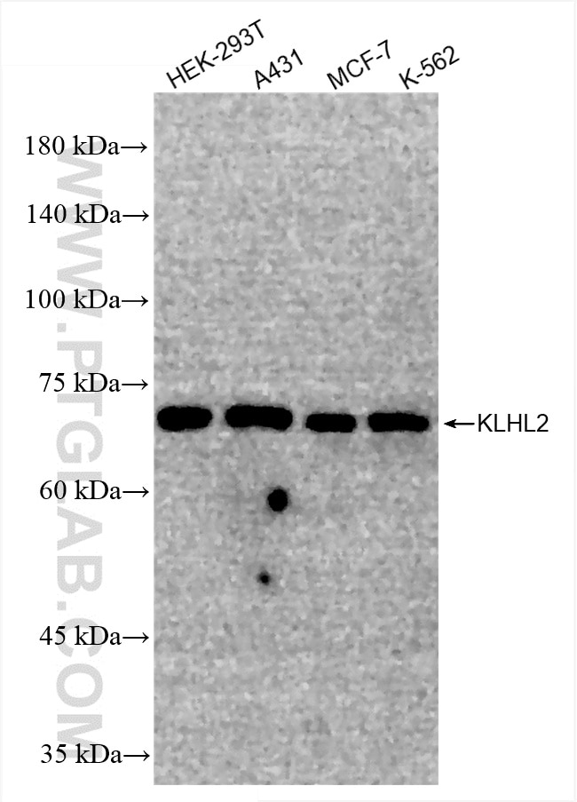 KLHL2