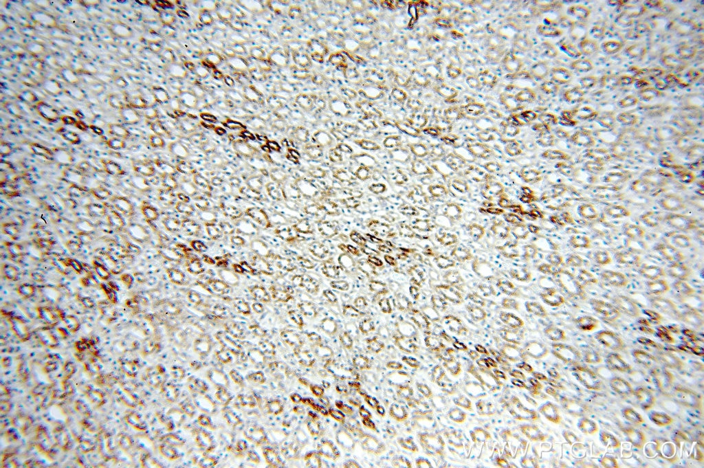 Immunohistochemistry (IHC) staining of human kidney tissue using KLHL20 Polyclonal antibody (18111-1-AP)