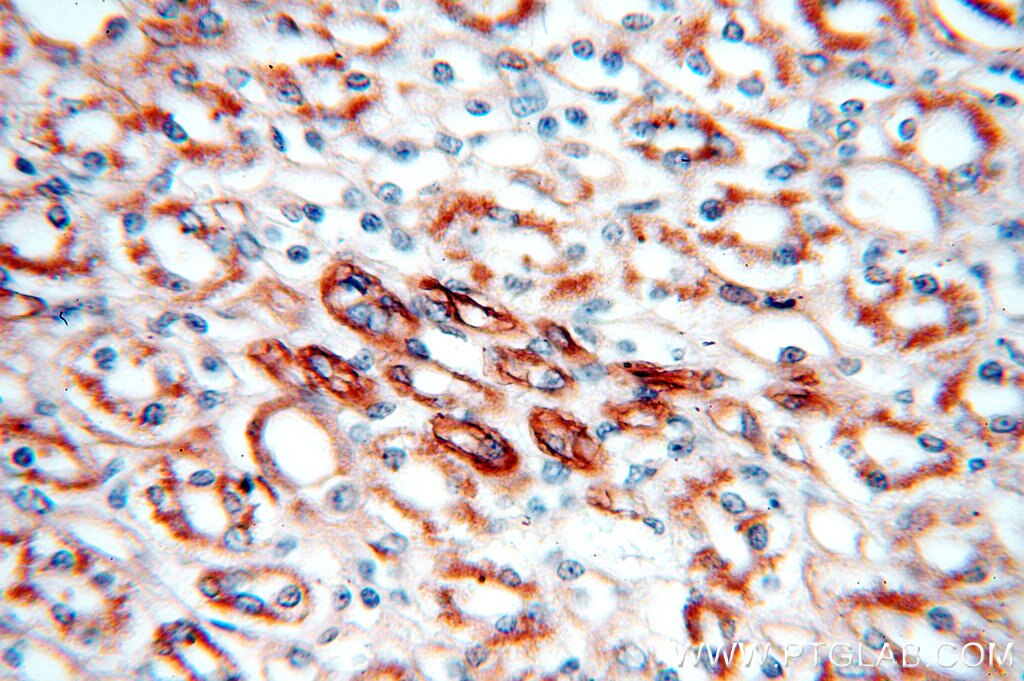 Immunohistochemistry (IHC) staining of human kidney tissue using KLHL20 Polyclonal antibody (18111-1-AP)