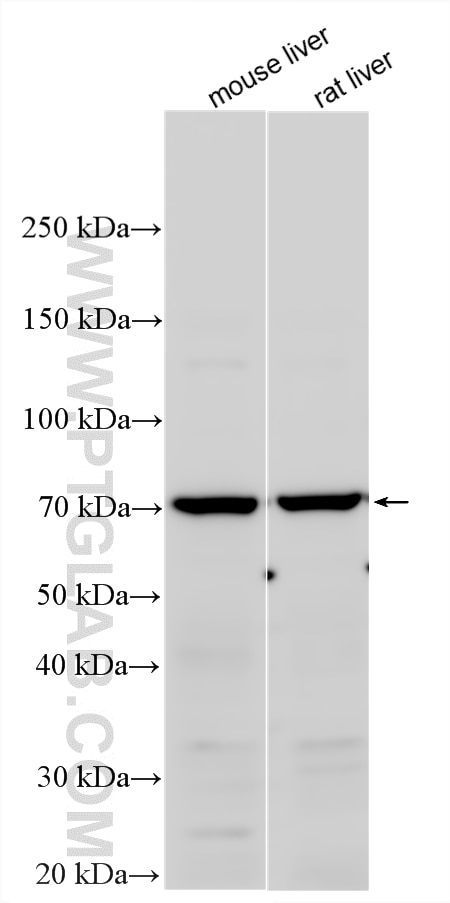 WB analysis using 18111-1-AP (same clone as 18111-1-PBS) Western Blot (WB) analysis of various lysates using KLHL20 Polyclonal antibody (18111-1-AP)
