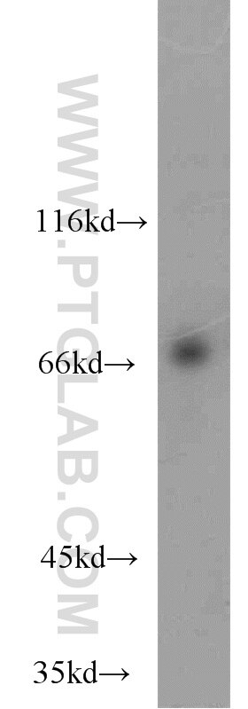 Western Blot (WB) analysis of HEK-293 cells using KLHL20 Polyclonal antibody (18111-1-AP)
