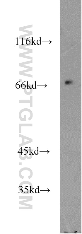 Western Blot (WB) analysis of HEK-293 cells using KLHL20 Polyclonal antibody (18111-1-AP)