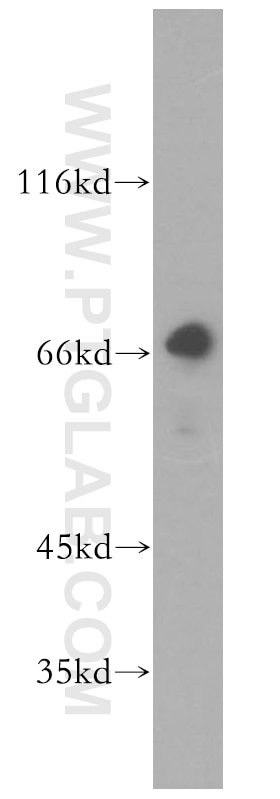 WB analysis of HEK-293 using 18111-1-AP