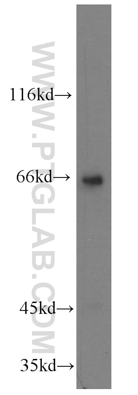 Western Blot (WB) analysis of mouse liver tissue using KLHL20 Polyclonal antibody (18111-1-AP)