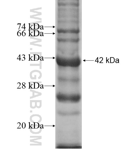 KLHL20 fusion protein Ag12567 SDS-PAGE