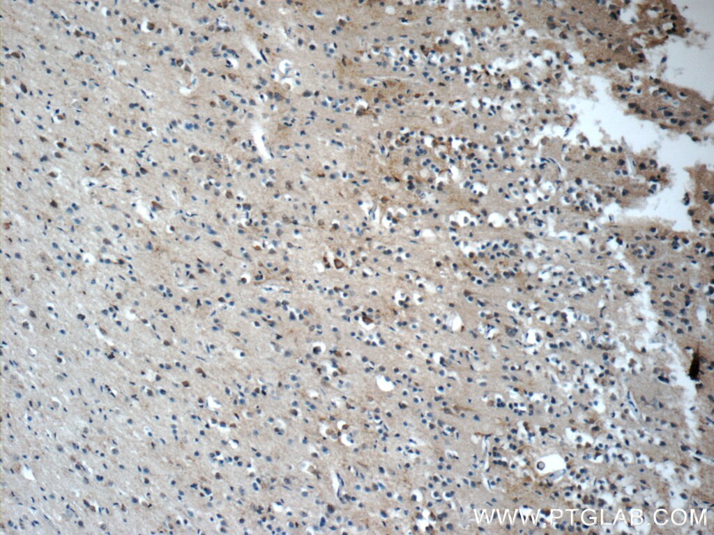 Immunohistochemistry (IHC) staining of human brain tissue using KLHL21 Polyclonal antibody (16952-1-AP)