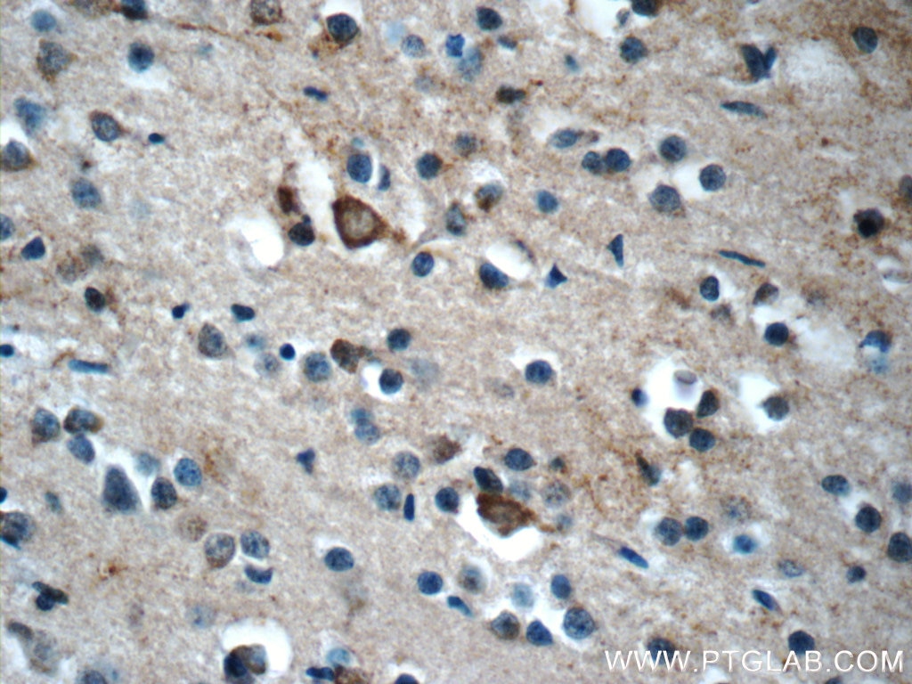 Immunohistochemistry (IHC) staining of human brain tissue using KLHL21 Polyclonal antibody (16952-1-AP)