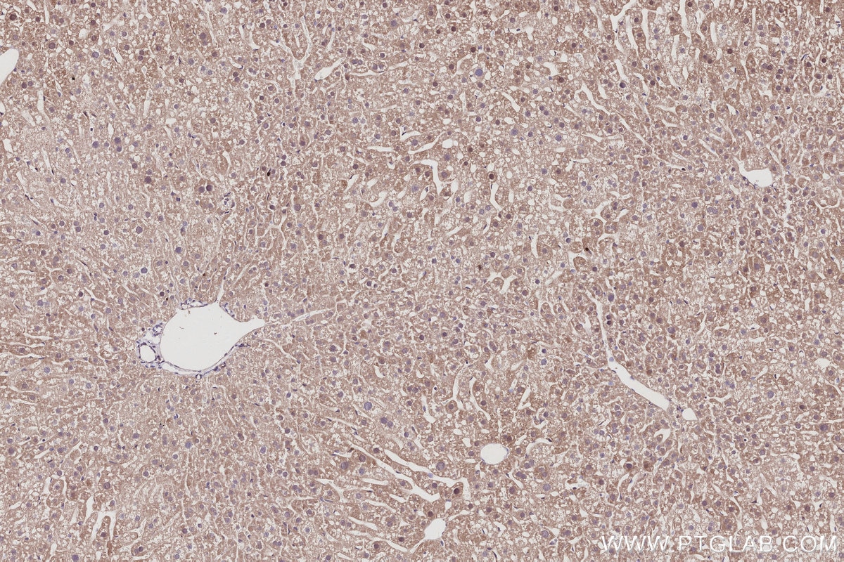 Immunohistochemistry (IHC) staining of mouse liver tissue using KLHL21 Polyclonal antibody (16952-1-AP)