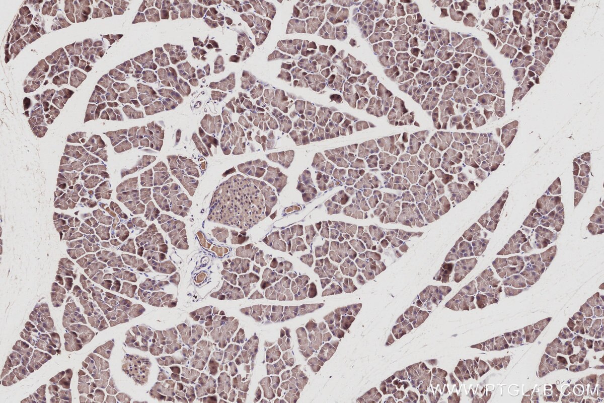 Immunohistochemistry (IHC) staining of mouse pancreas tissue using KLHL21 Polyclonal antibody (16952-1-AP)