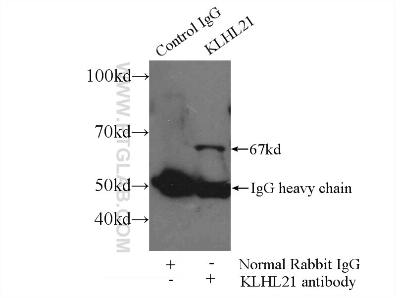 Immunoprecipitation (IP) experiment of HeLa cells using KLHL21 Polyclonal antibody (16952-1-AP)